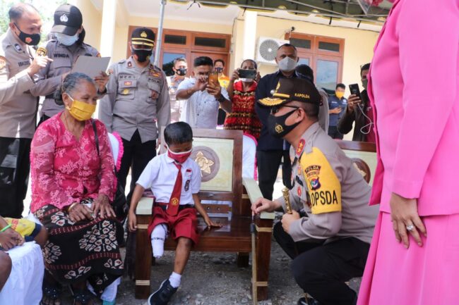 Kupang Kapolda sumbang kaki palsu