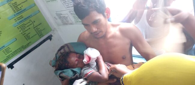 Mabar komodo gigit anak
