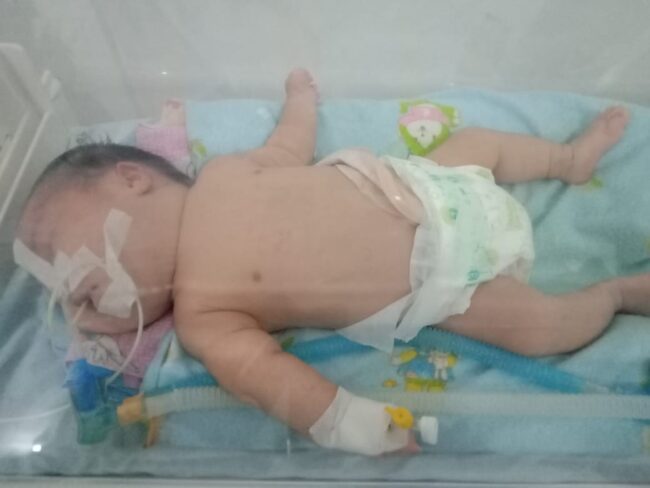 Manggarai rafael tanpa anus